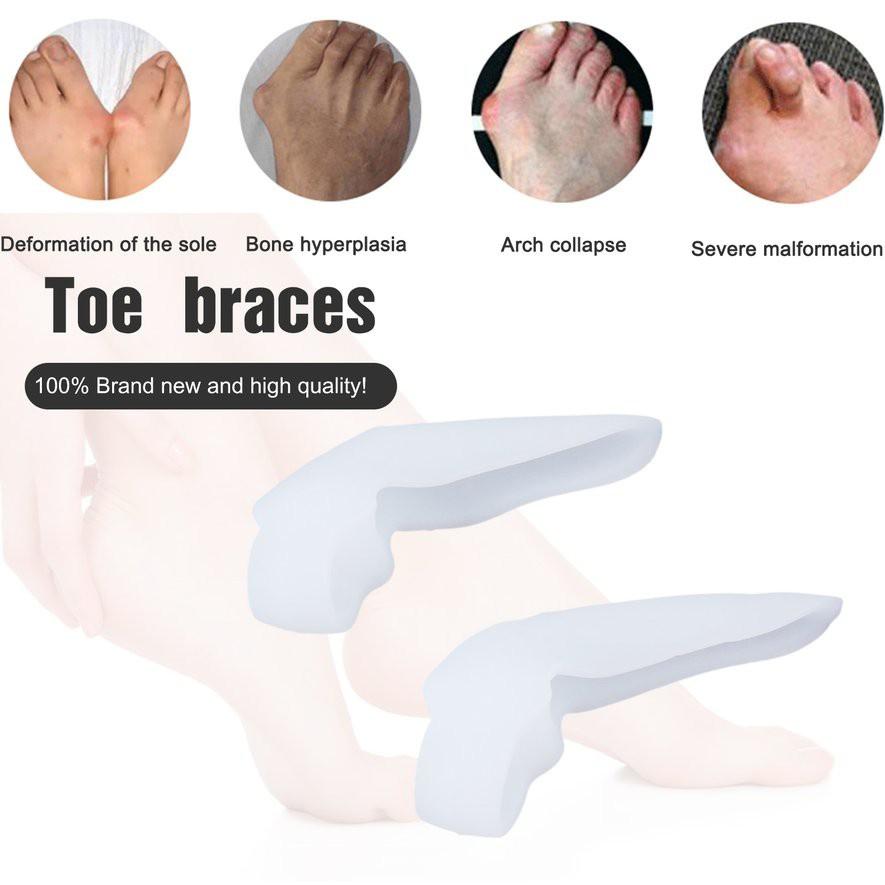 1 Cặp Dụng Cụ Silicone Điều Chỉnh Ngón Chân Cái