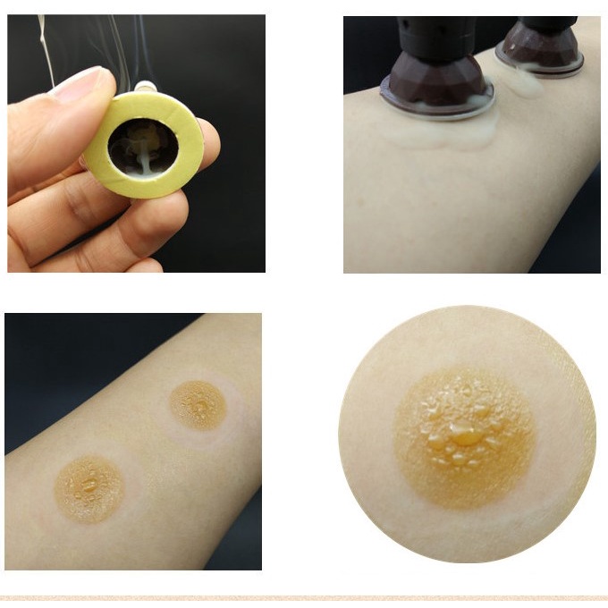 Hộp 50 Nhang ngải cứu dán 7 mm và 10 mm, ngải đoạn có đế dán cố định