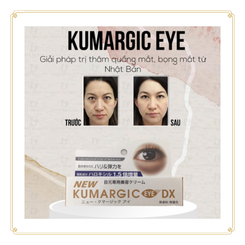 Kem mắt Kumargic Eye 20g hàng chuẩn Nhật Bản.