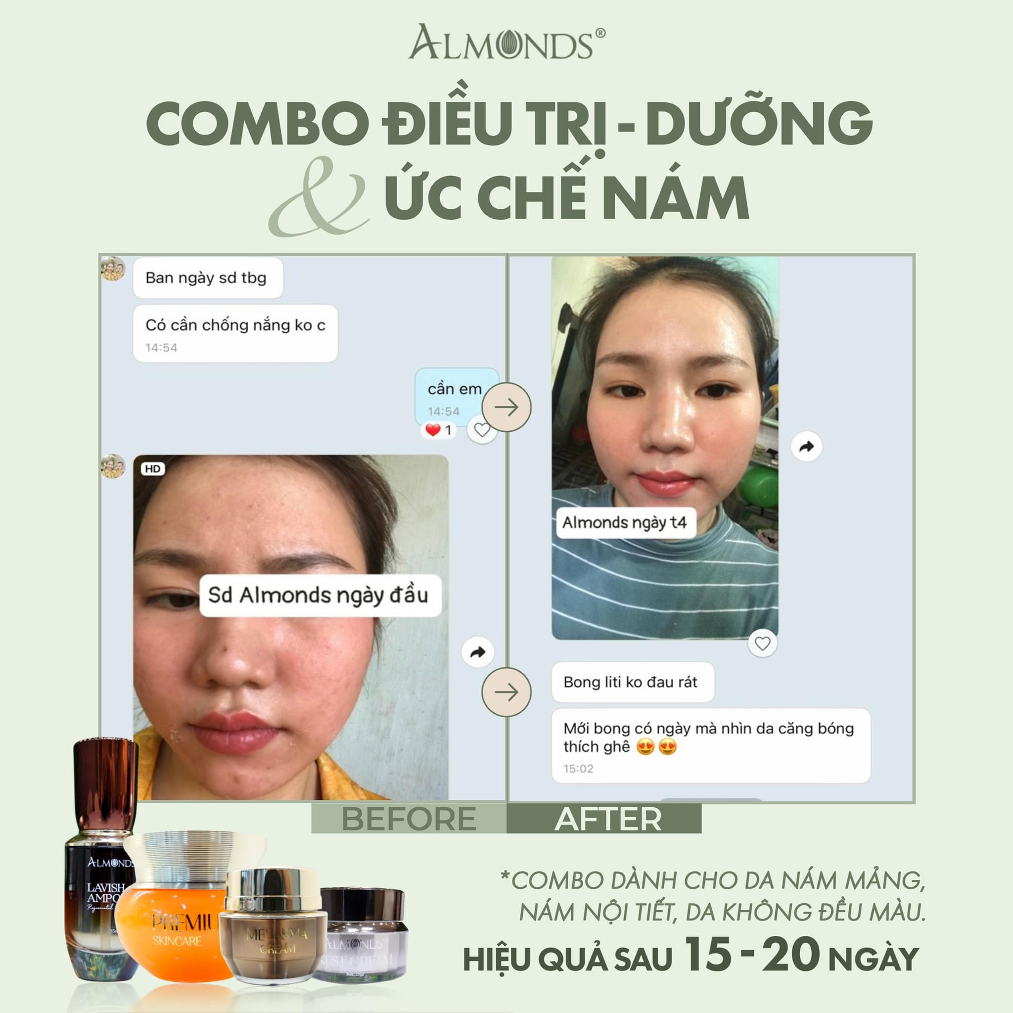 Kem Tái Tạo đánh bay Nám Almonds Melasma Cream 20g