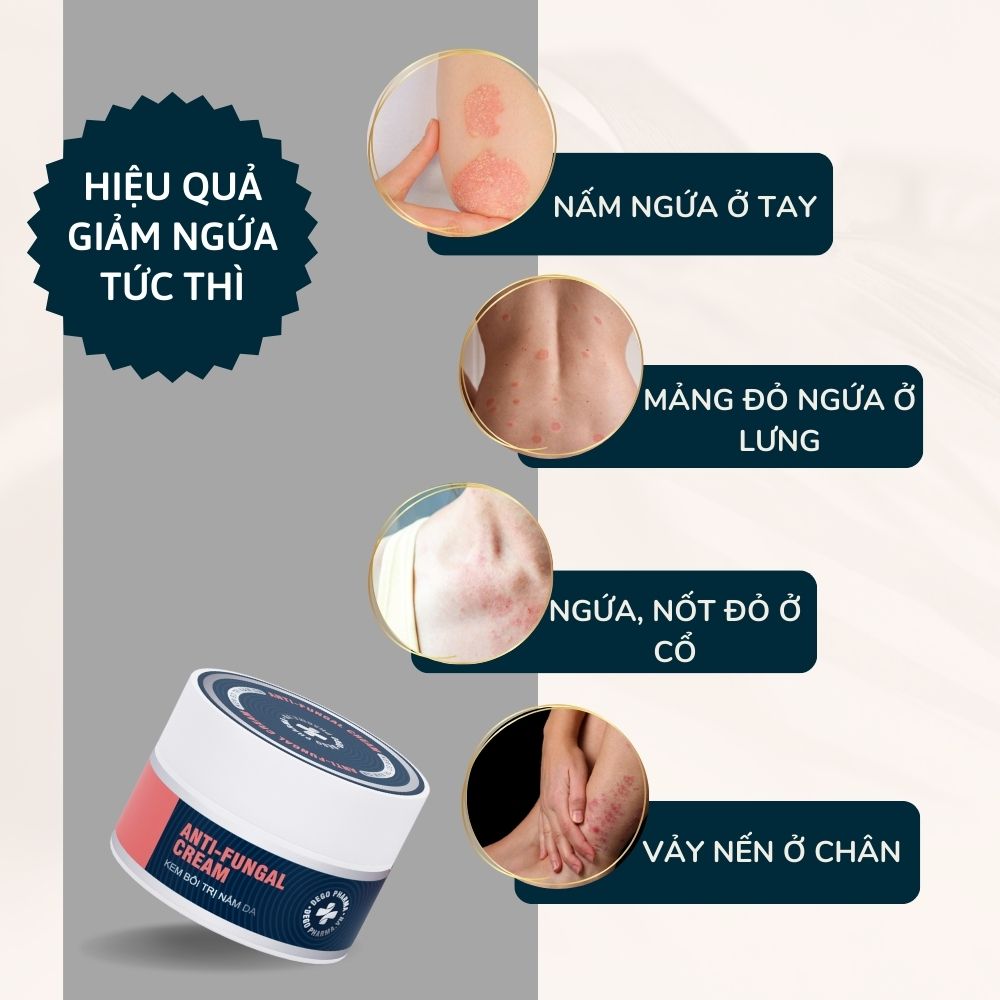 Kem bôi dứt điểm nấm da đầu, vảy nến, á sừng, eczema Dego Pharma 