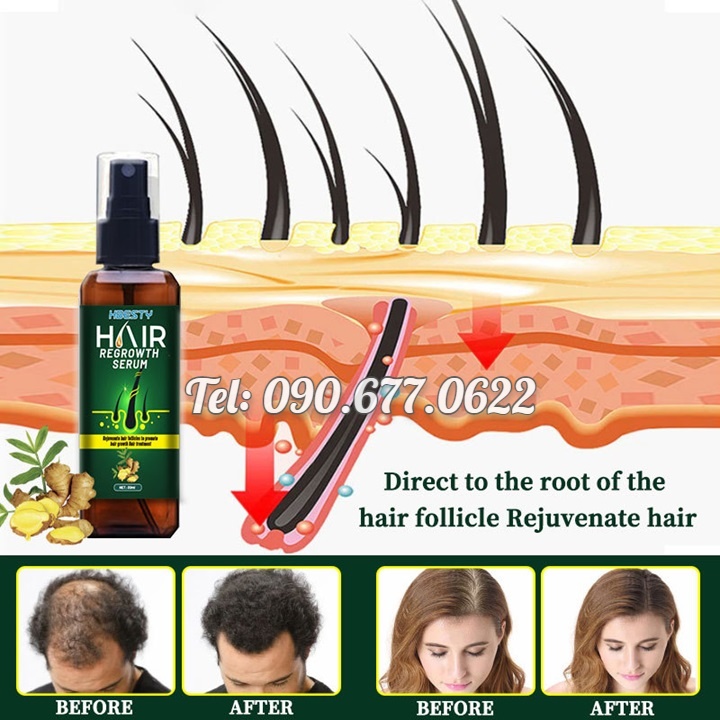 Serum dưỡng kích mọc tóc, giúp tóc mọc nhanh, mọc nhiều và dày, sợi tóc đen bóng xuất xứ Nhật Bản – Mã số 1230