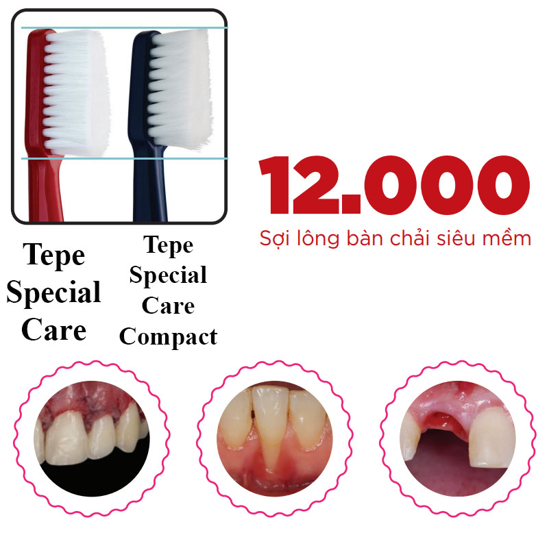 Bàn chải đánh răng siêu mềm màu đỏ - dùng sau phẫu thuật răng miệng Tepe Special Care