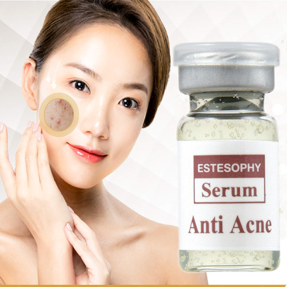 Serum đặc t rị cho da mụn es te so phy giúp tái tạo tế bào da tổn thương và chống mụn