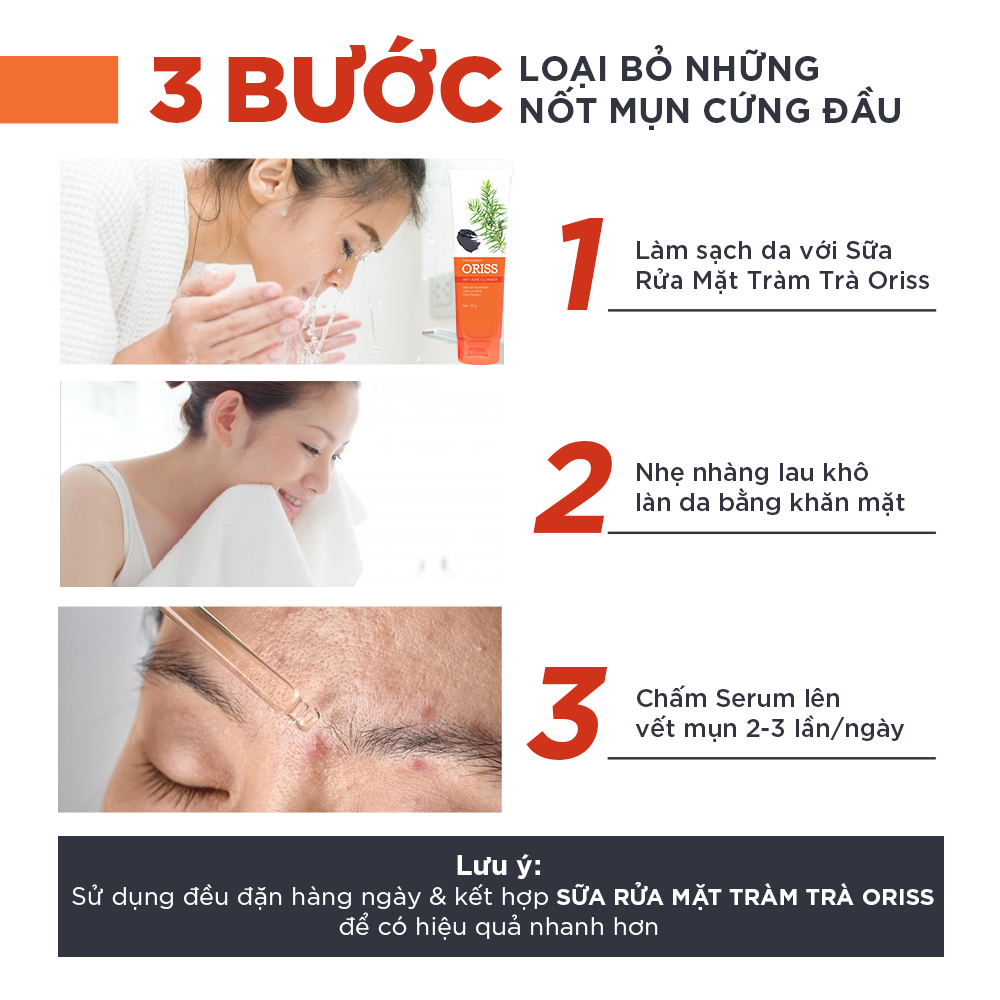 Serum Ngừa Mụn Dưỡng Trắng Da Oriss Cao Cấp