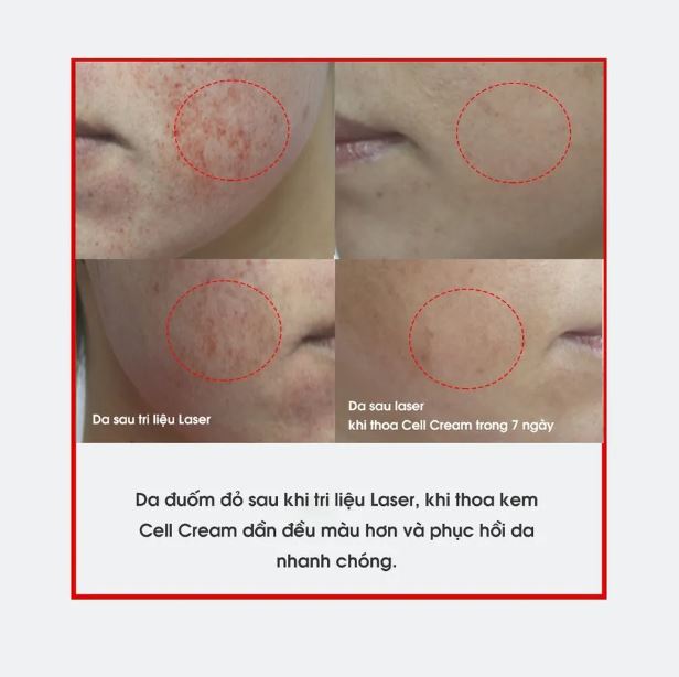 Kem Dưỡng Da Sau Laser Post Care Histolab Cell Cream 50ml