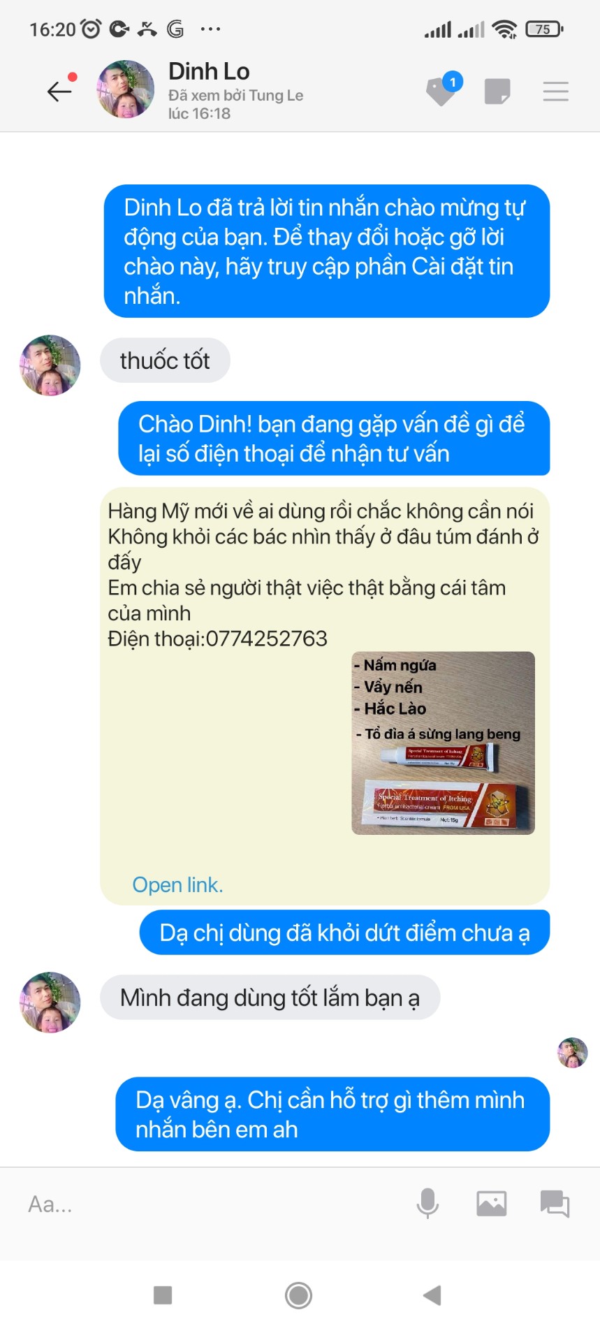 Kem bôi nấm ngứa Mỹ Special Treatment Of Itching