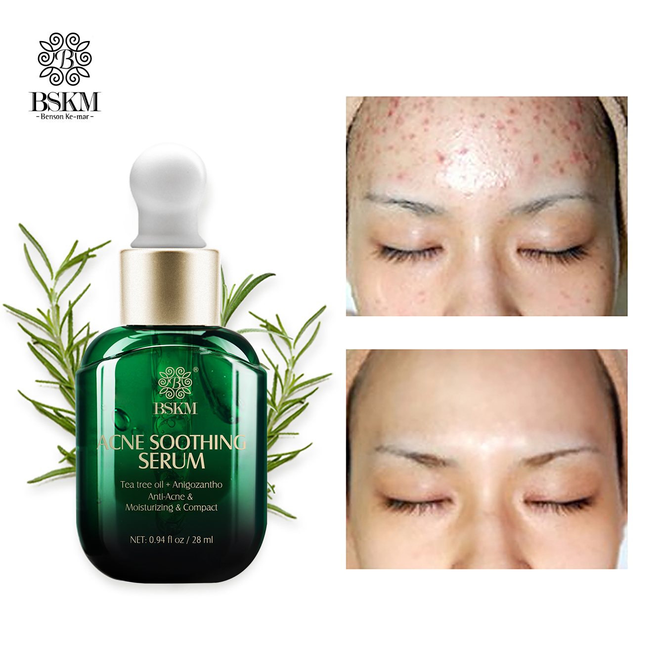 BSKM Gel cải thiện mụn + Kem dưỡng ẩm da mặt + Tinh chất làm săn chắc da Dưỡng ẩm và làm mờ nếp nhăn Thu nhỏ lỗ chân lông Bộ chăm sóc da mặt