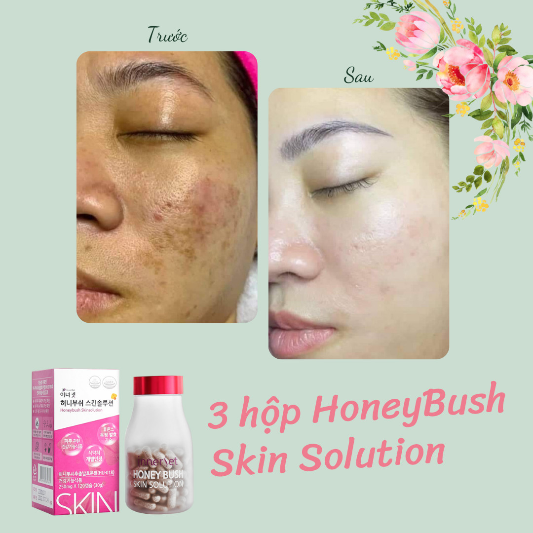 Viên uống chống nắng HoneyBush Skin Solution Hàn Quốc 120 viên