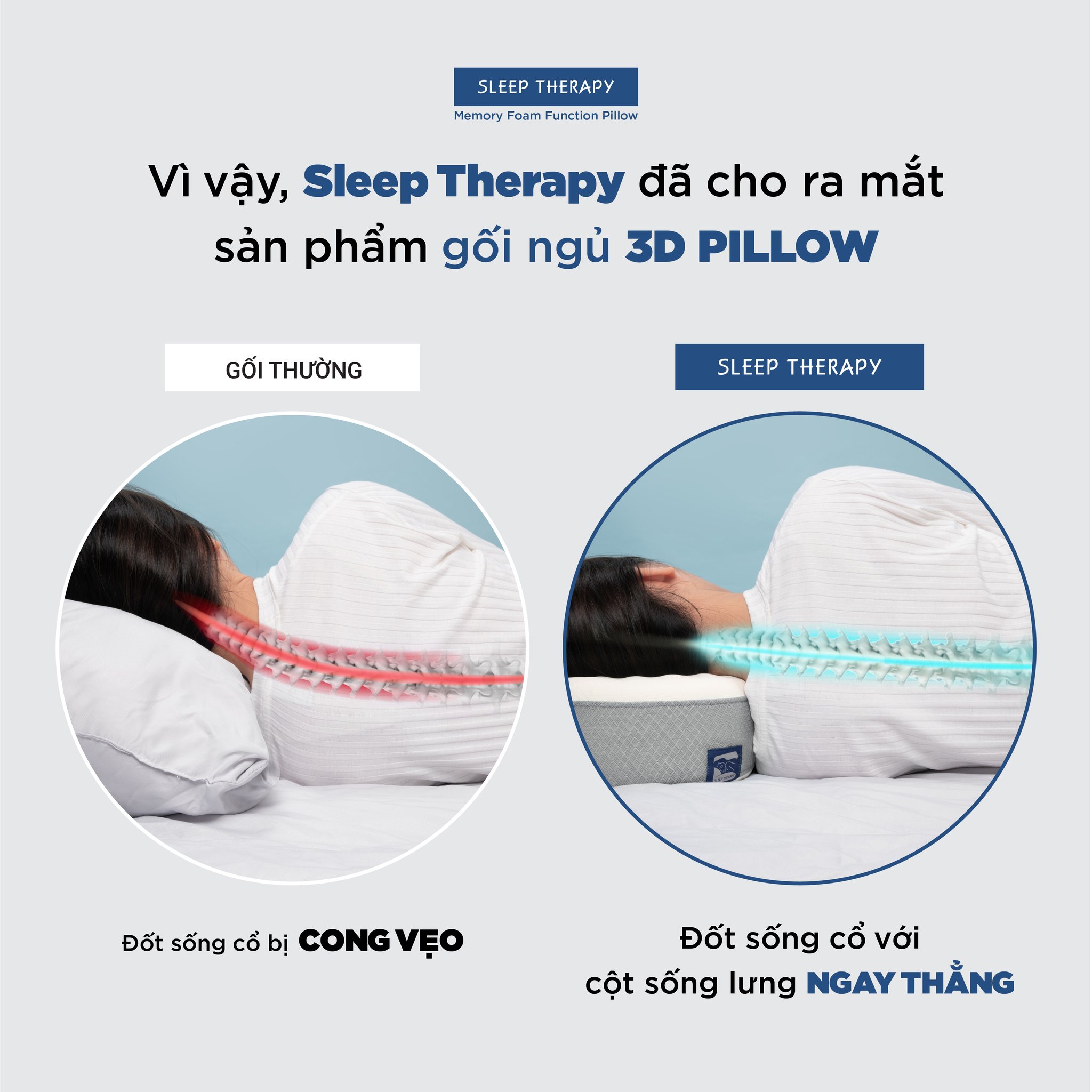 Gối ngủ ngon giảm đau vai gáy cổ người lớn - Sleep Therapy - Memory Foam