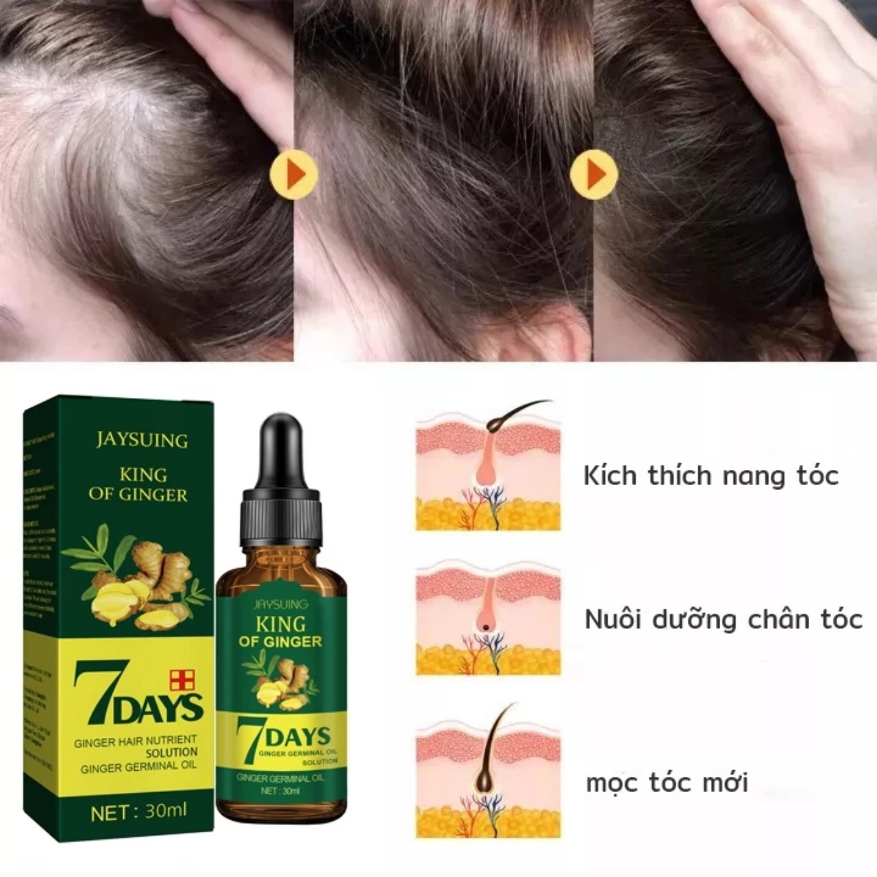 Mọc Tóc Mạnh Mẽ với Tinh Dầu Xịt ELHOE: Tinh Chất Nhân Sâm và Gừng Tươi Hiêu Qủa Sau 7 Ngày