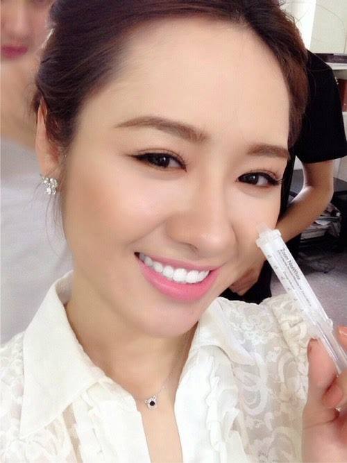 Gel tẩy trắng răng Nite White date 2024