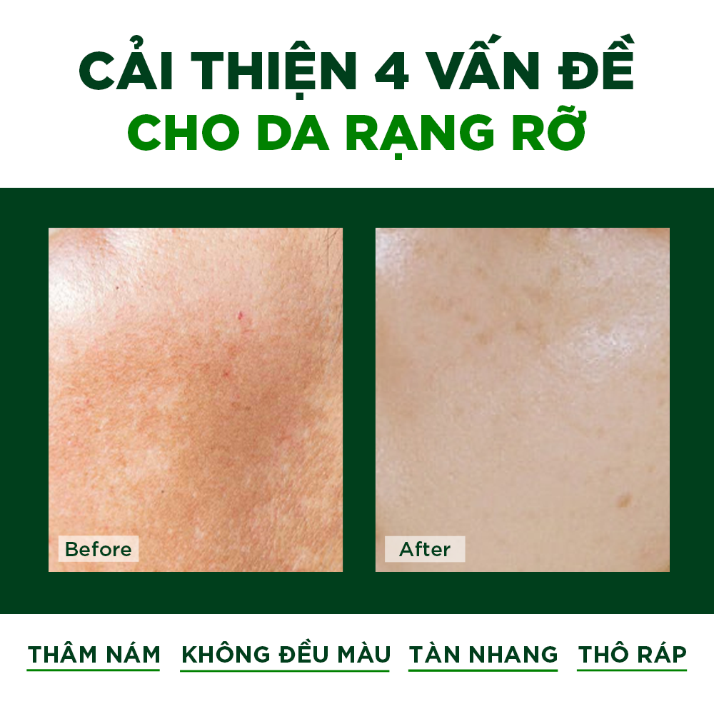 Viên Uống Đẹp Da Chống Nám Ngăn Ngừa Lão Hóa Oribe
