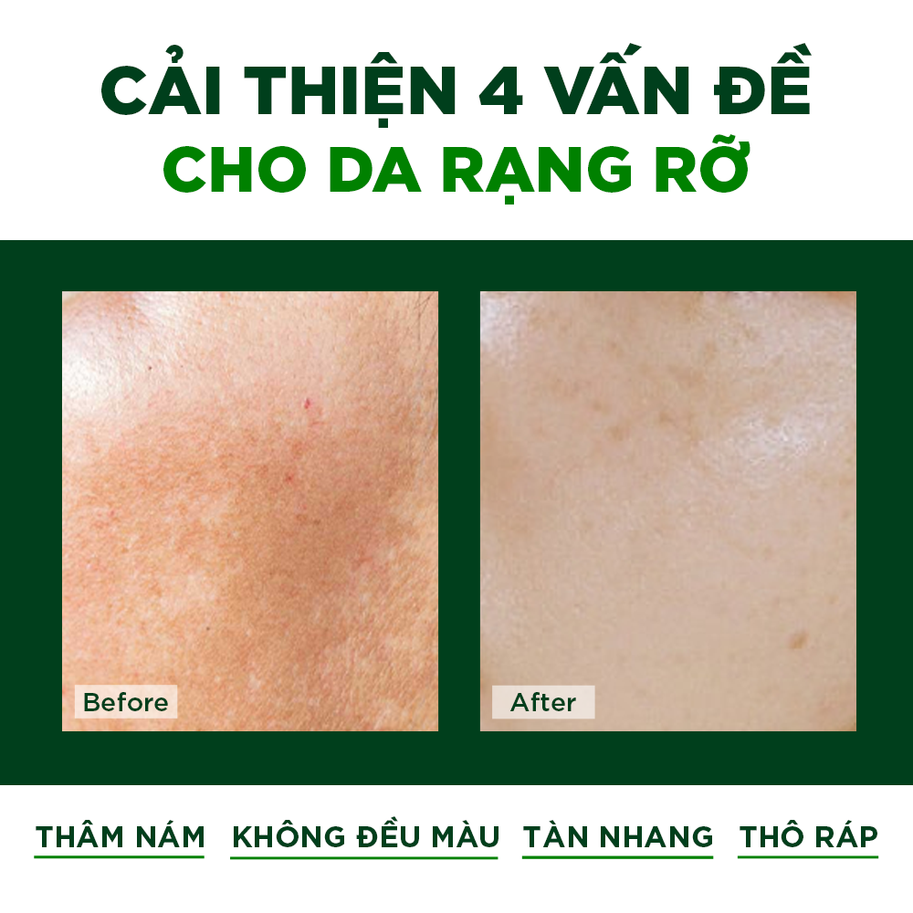 Viên Uống Đẹp Da Chống Nám Ngăn Ngừa Lão Hóa Oribe (Hộp 30 viên)