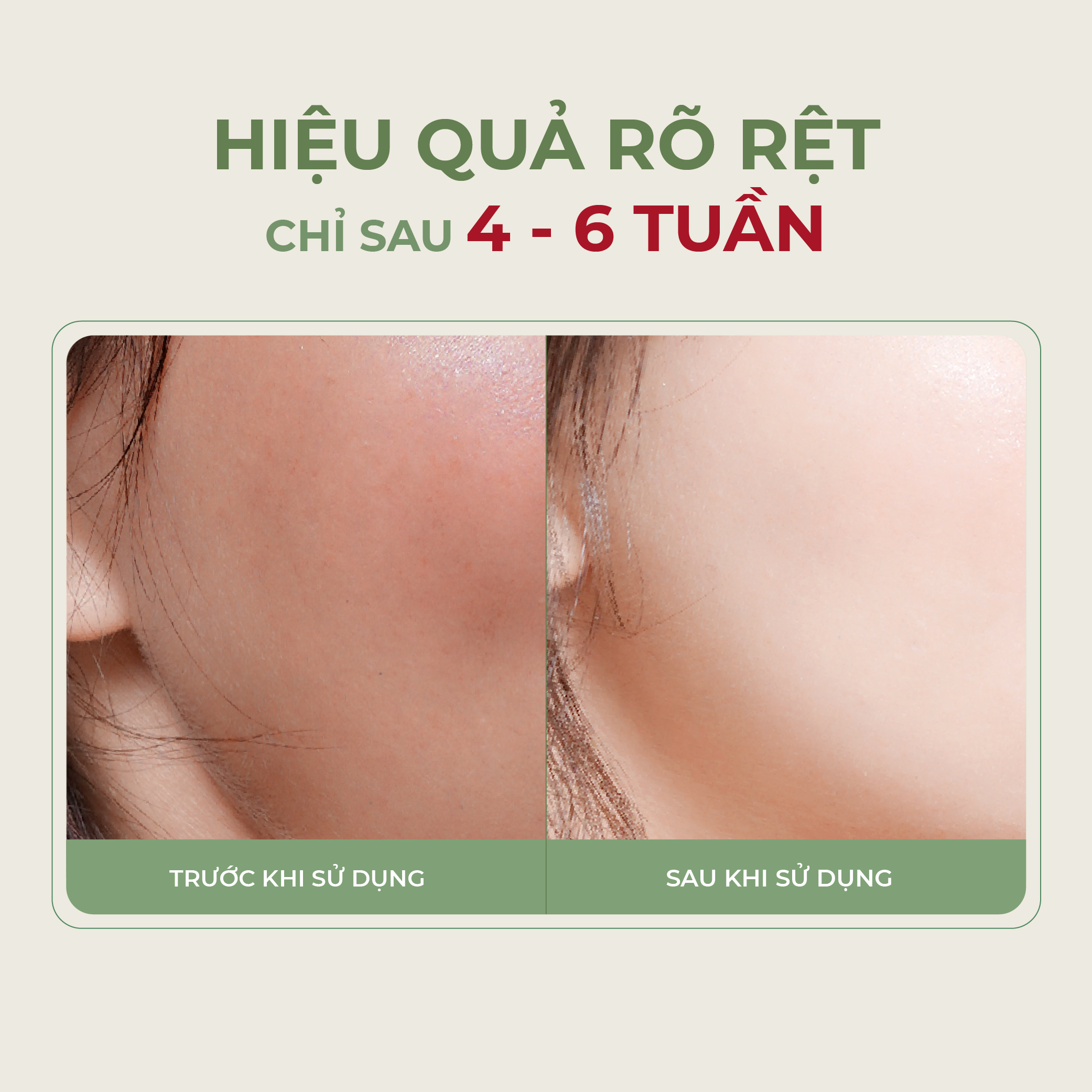 Serum Trắng Da Abera Dưỡng Cho Da Trắng Sáng, Mịn Màng, Ngăn Ngừa Kích Ứng