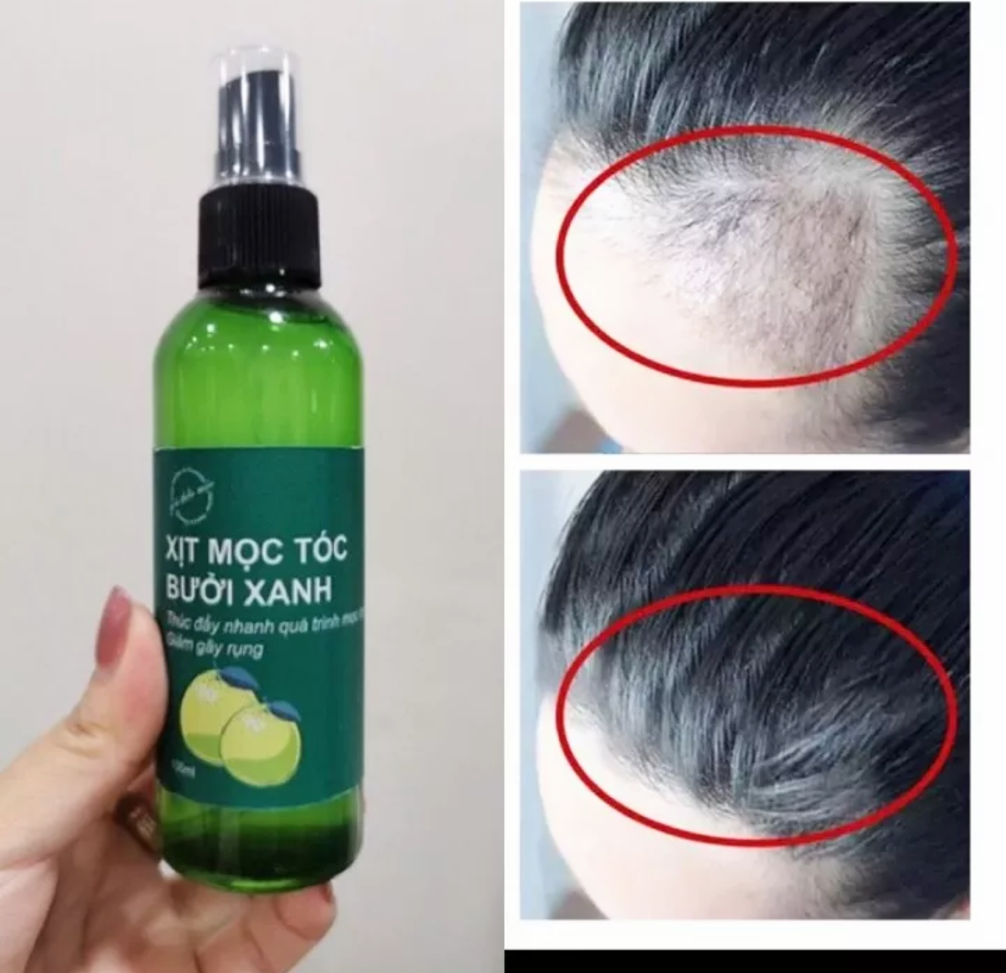 SIÊU GIÁ VỚI 1 CHAI TINH DẦU BƯỞI XANH KÍCH THÍCH MỘC TÓC DƯỠNG CHĂM SÓC TÓC HIỆU QUẢ HÀNG CAO CẤP