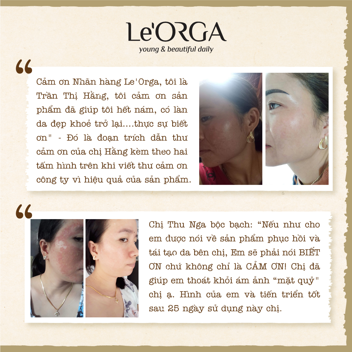 LE'ORGA SERUM DETOX WHITE 30ml 