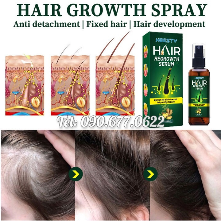 Serum dưỡng kích mọc tóc, giúp tóc mọc nhanh, mọc nhiều và dày, sợi tóc đen bóng xuất xứ Nhật Bản – Mã số 1230