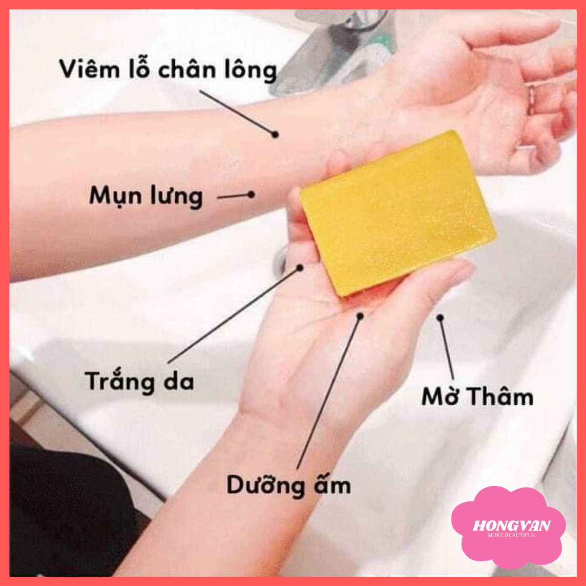 Combo 2 bánh xà bông nghệ và mật ong (2x100g) giúp sáng da ngừa mụn giảm thâm tặng lưới tạo bọt