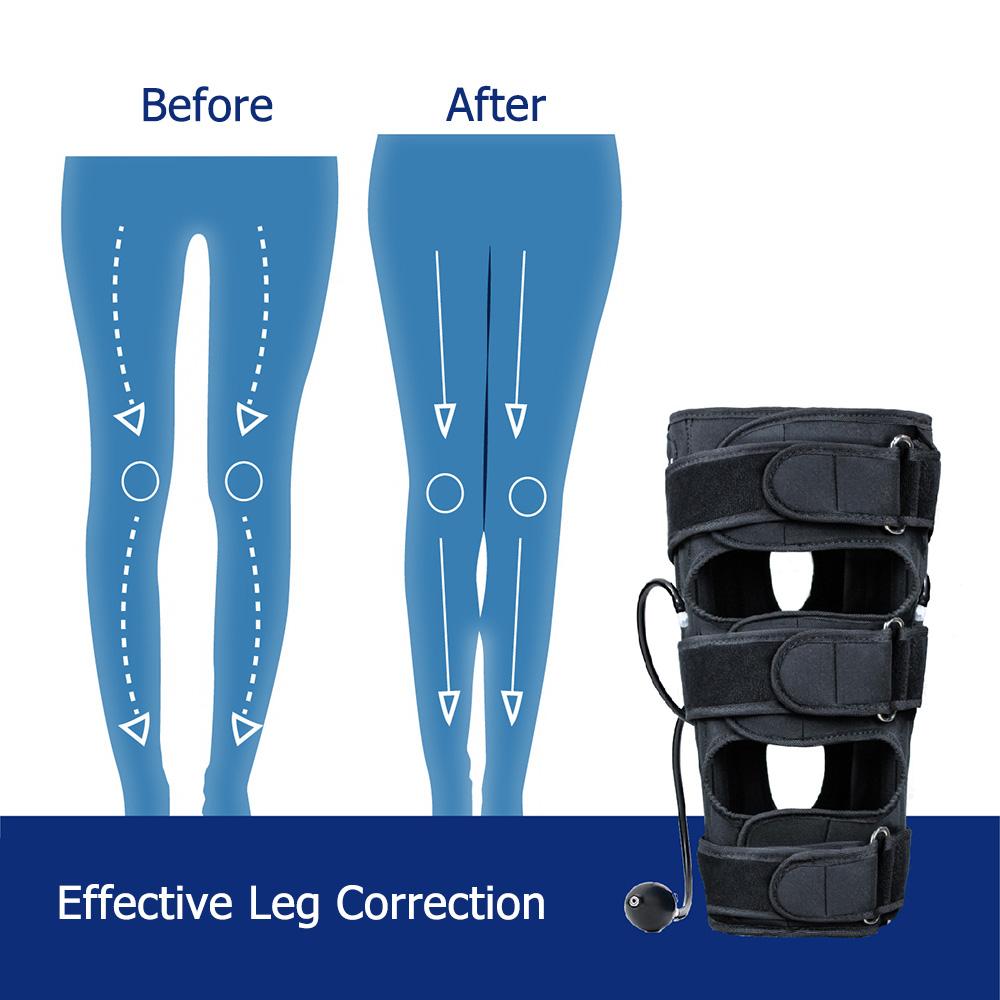 Áp Suất O/X Loại Chân Tư Thế Corrector Ban Nhạc Cúi Đầu Chân Đầu Gối Valgum Thẳng Làm Đẹp Bơm Hơi Chân Dây Cho Người Trưởng Thành trẻ Em Nẹp