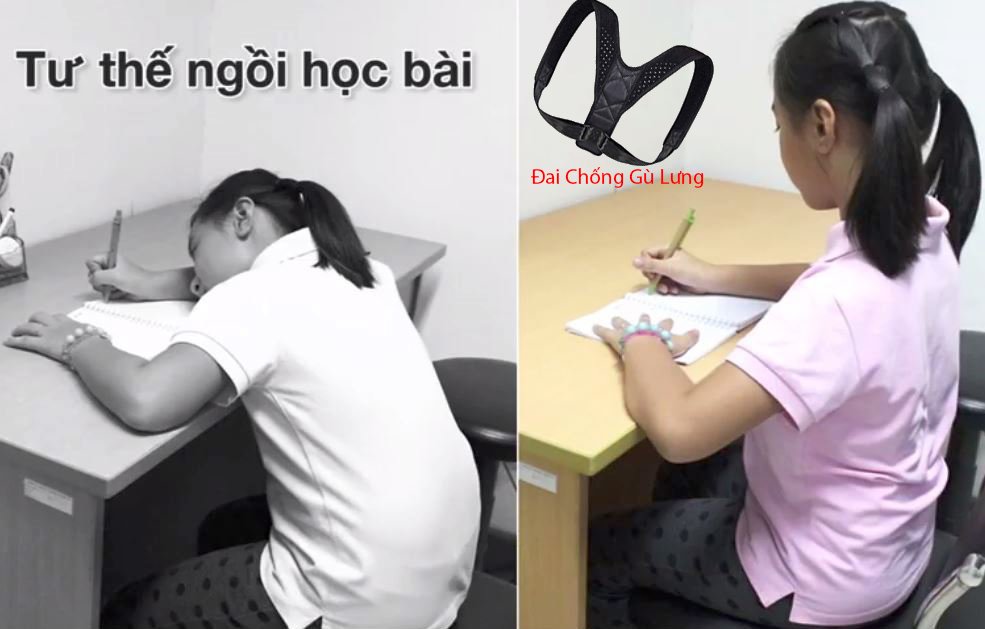 Đai Chống Gù Cải Thiện Cột Sống Cho Người Lớn Free Size Dùng Được Cho Cả Nam Và Nữ - Hàng Nhập Khẩu
