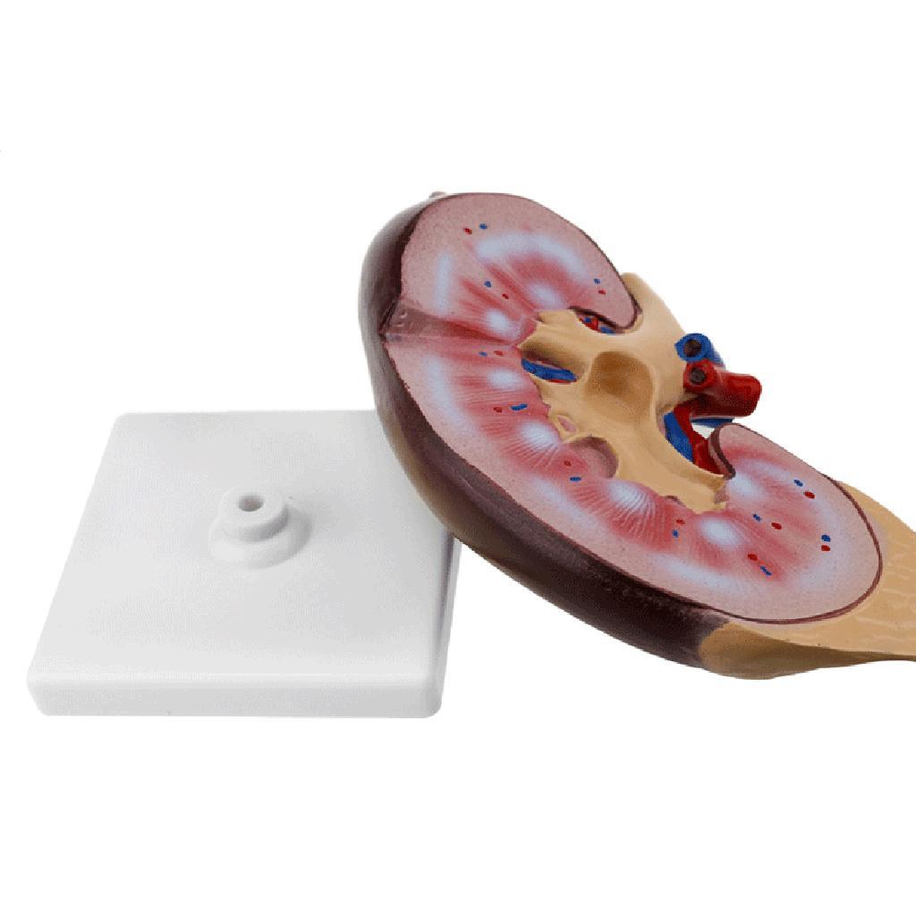 Kidney Anatomical Anatomy Kidney Model Expansion Display Teaching Supplies