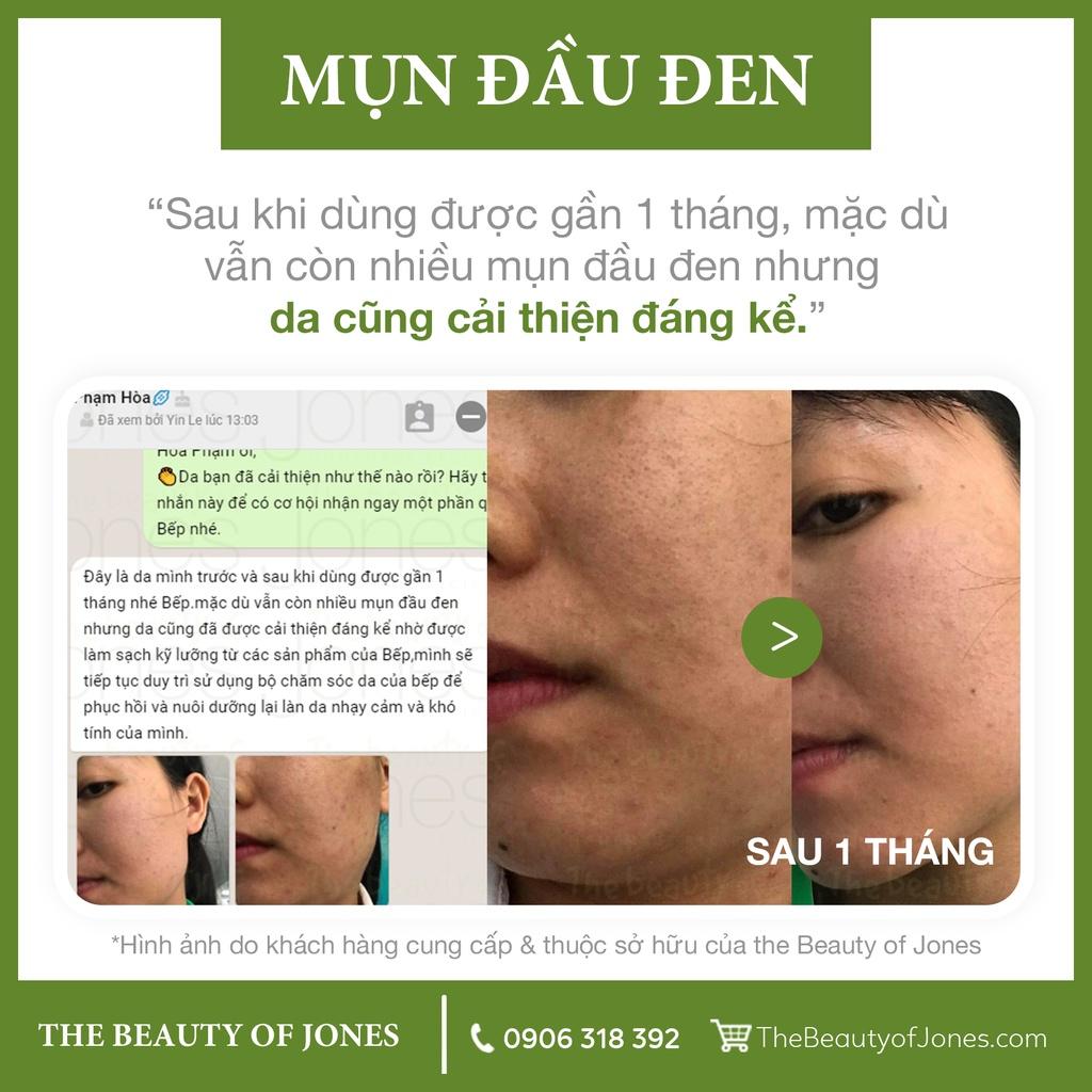 Combo cấp ẩm và chống nắng cho da dầu The Beauty of Jones