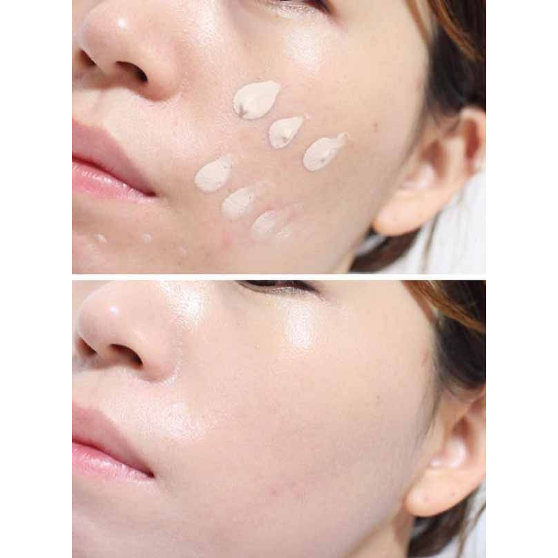 Kem Dưỡng Da Civasan Meso Blemish Balm (35ml) – Nâng tone &amp; Bảo vệ da
