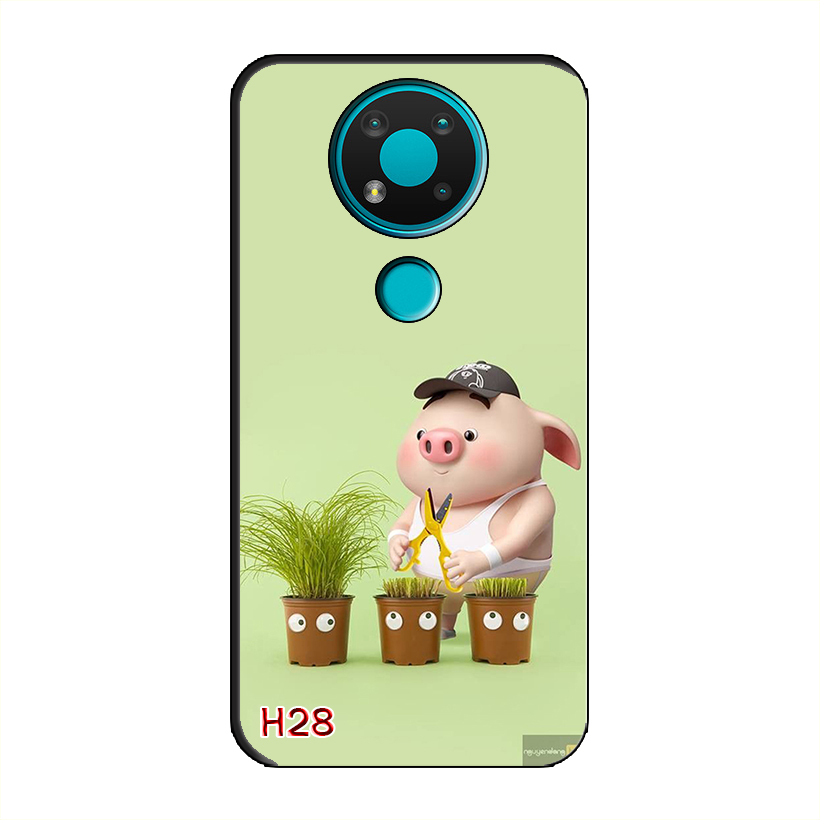 Ốp Dẻo Dành Cho NOKIA 3.4