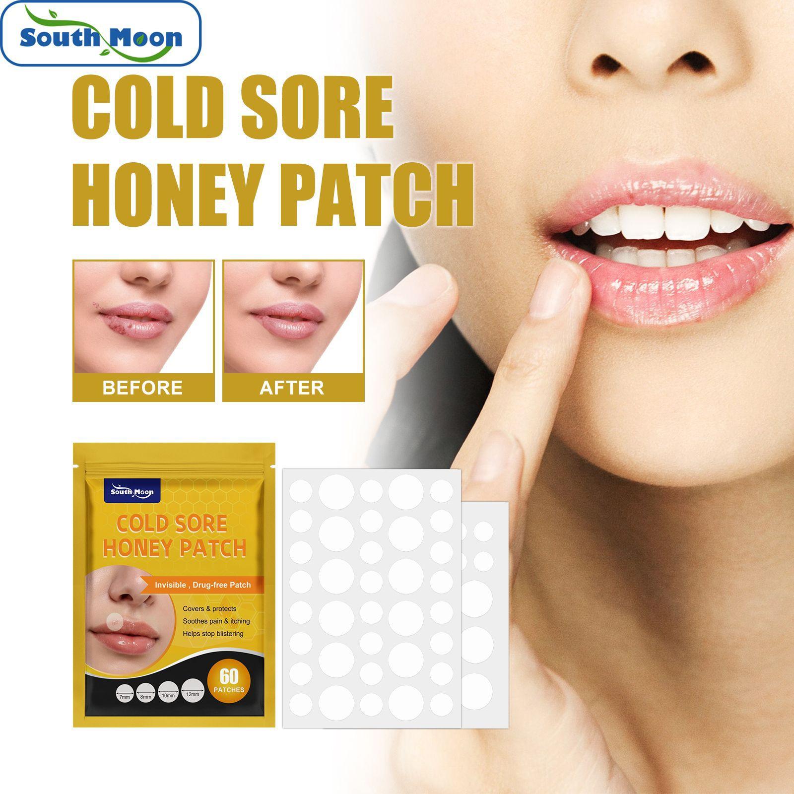 South Moon 60 patches Cold Sore Honey Patch Blister Treatment Conceals Protects Soothes & Hides Cold Sores