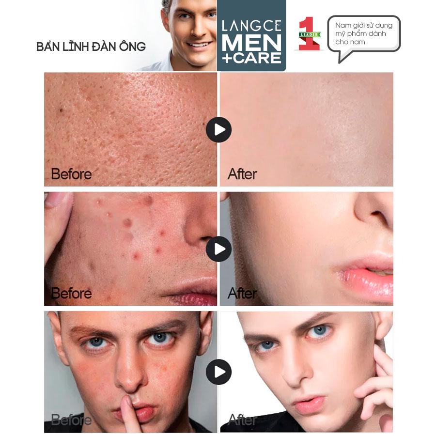 TOTAL BEAUTY MAKE UP KEM NỀN CHE KHUYẾT ĐIỂM + HÌNH XĂM, KIỀM DẦU DƯỠNG ẨM DA 30ml LANGCE DÀNH CHO NAM