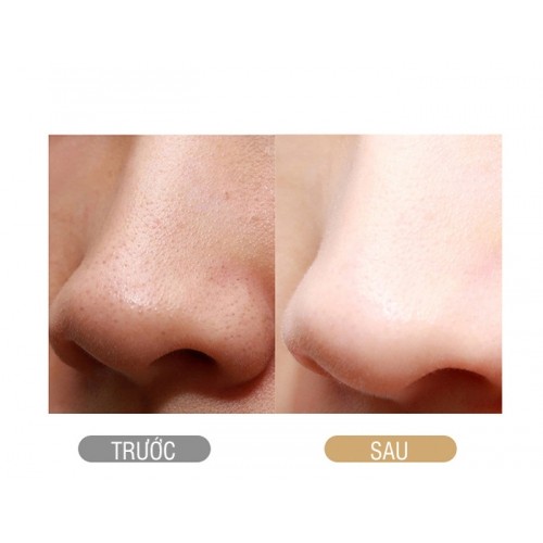 Máy Sủi Da Tẩy Tế Bào Chết Nikio NK-122 - Massage Nâng Cơ Mặt Hỗ Trợ Tạo Hình Vline, Xóa Nhăn, Chống Lão Hóa, Săn Chắc Da, Làm Sạch Da Chuyên Nghiệp