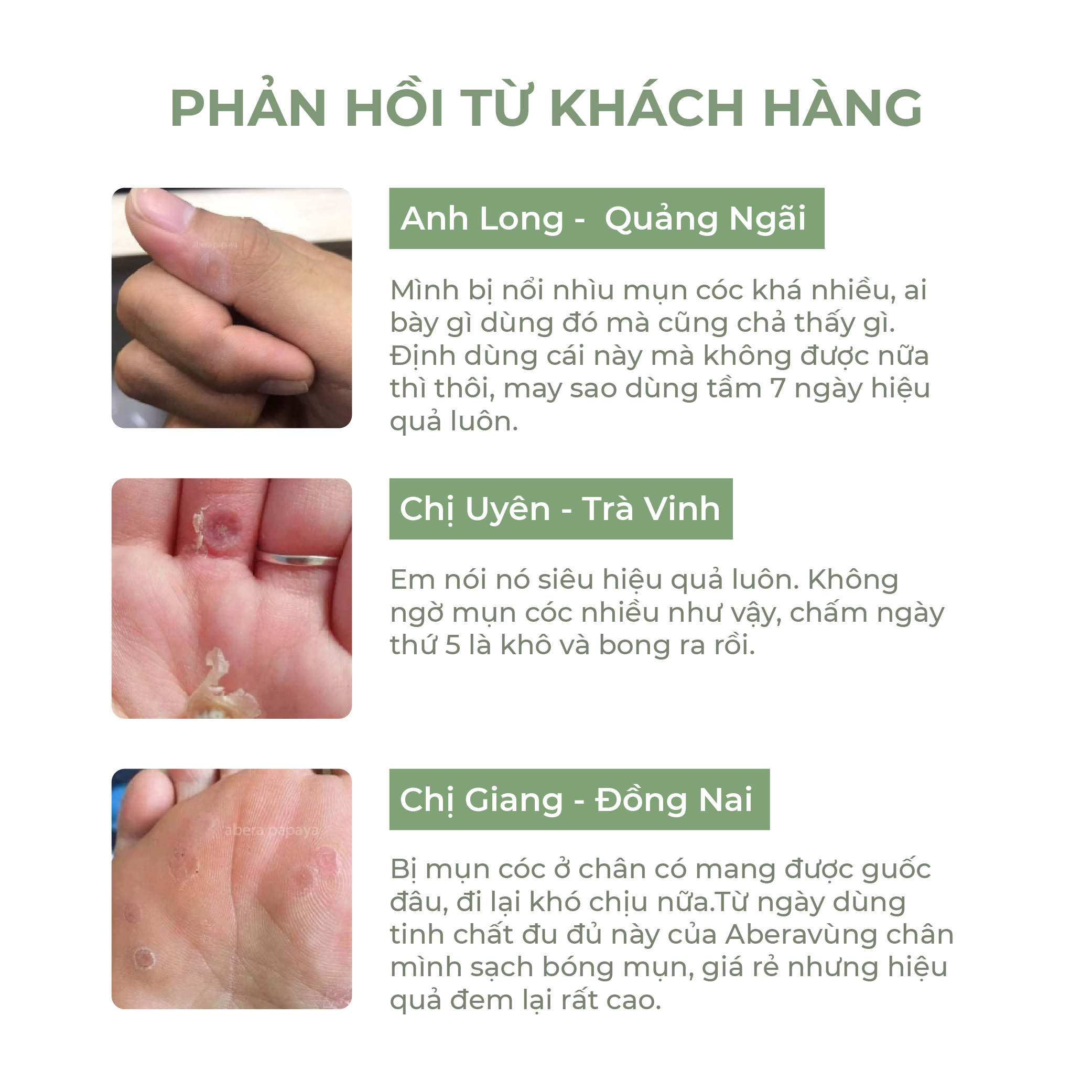 Tinh chất Đu Đủ PAPAYA ABERA 7ml Xử Lý Mụn Cóc, Mụn Cơm, Mụn Thịt Sau 7 Ngày