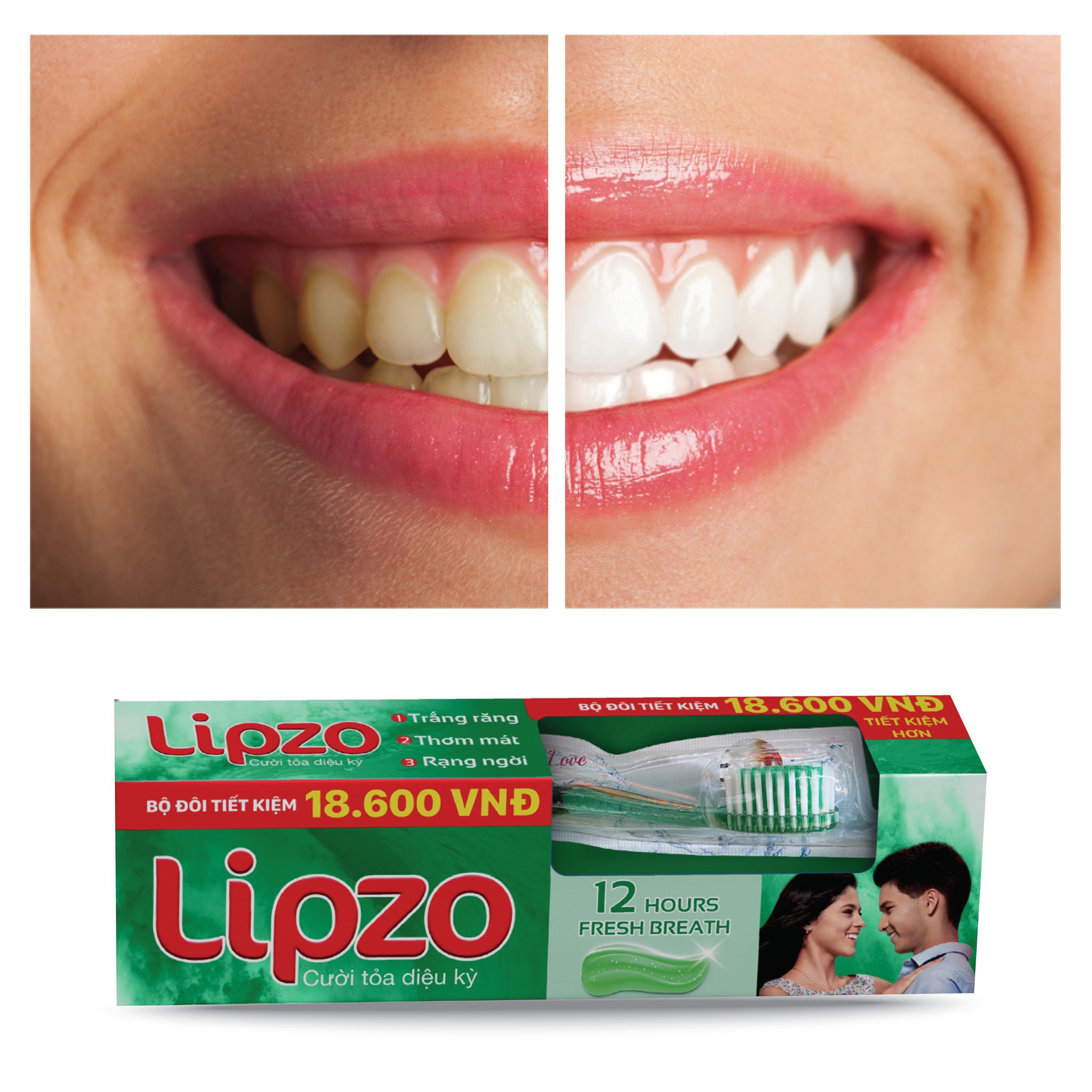 Bộ Đôi Kem Đánh Răng Lipzo 12 Giờ Rạng Ngời 185g Và Bàn Chải Đánh Răng Maxcare