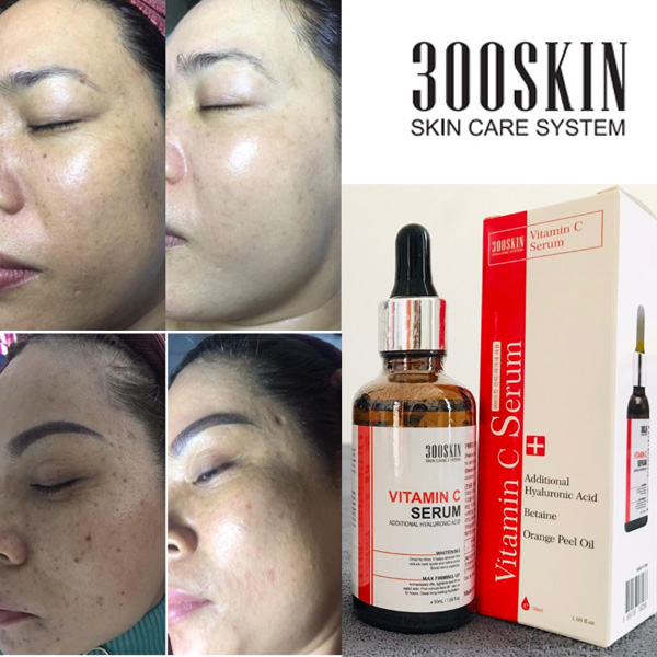 TINH CHẤT VITAMIN C TRẮNG DA, CẤP NƯỚC, PHỤC HÔI DA 300SKIN HYALURONIC ACID SERUM 50ML