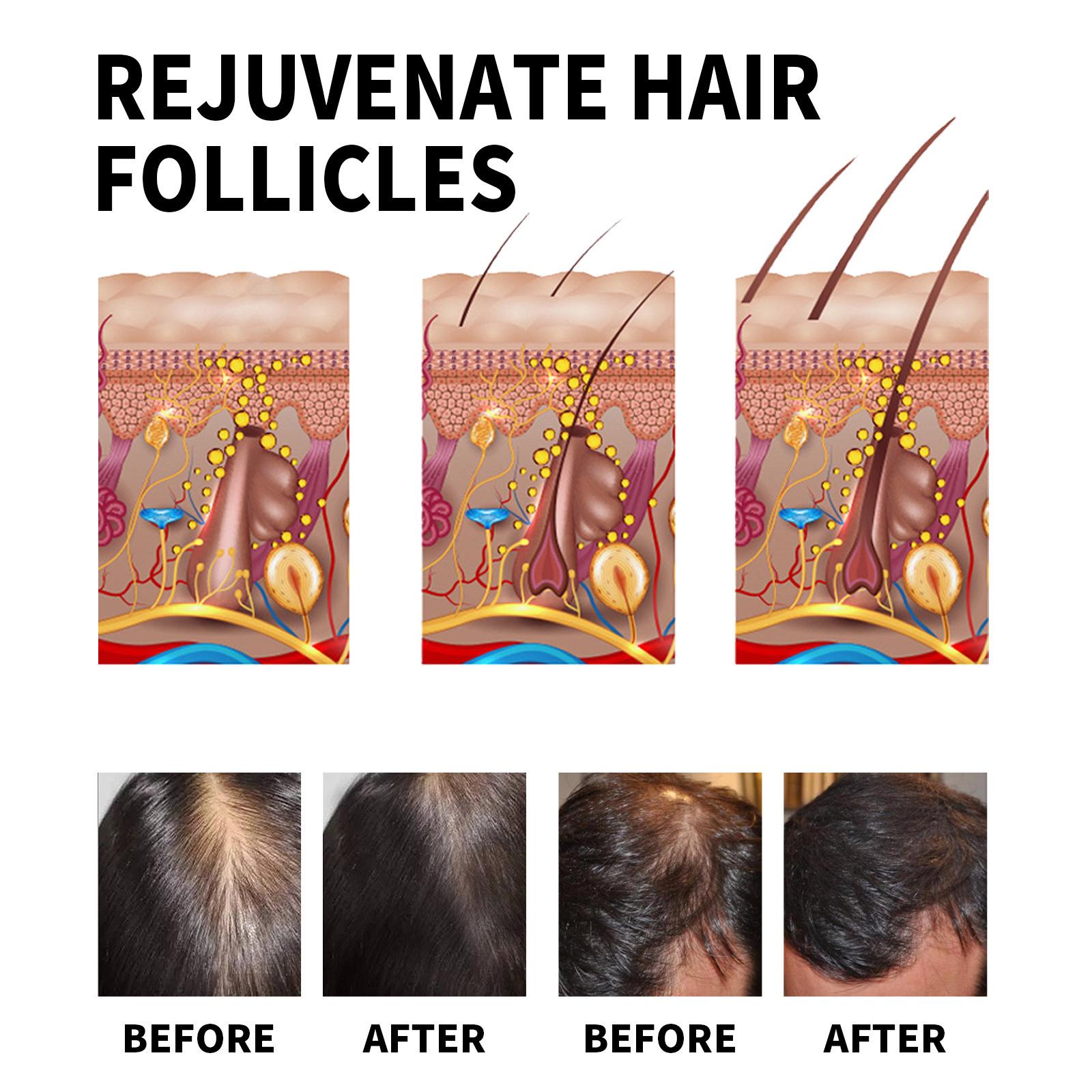 Jaysuing 60ml Hair Loss Solution Serum Natural Essence Prevent Hair Loss Stimulate Scalp Plumping Up