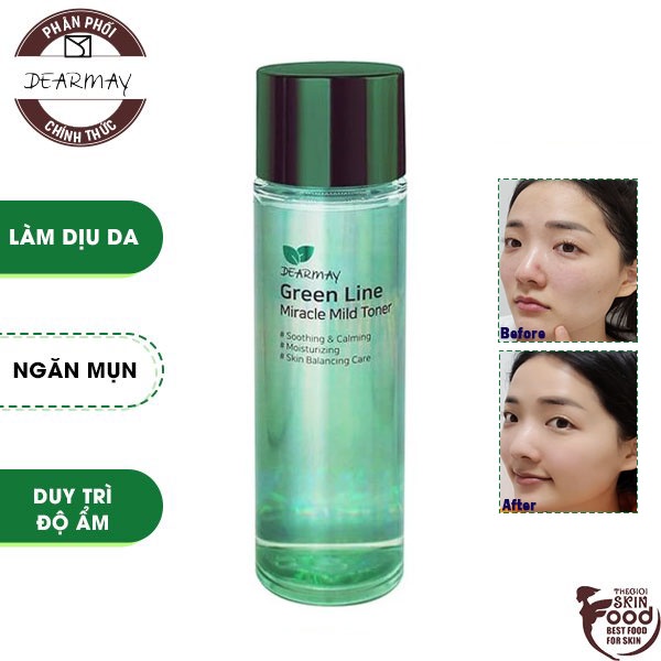 Nước Hoa Hồng Cân Bằng, Làm Dịu Da Chiết Xuất Thiên Nhiên Dearmay Green Line Miracle Mild Toner 150ml