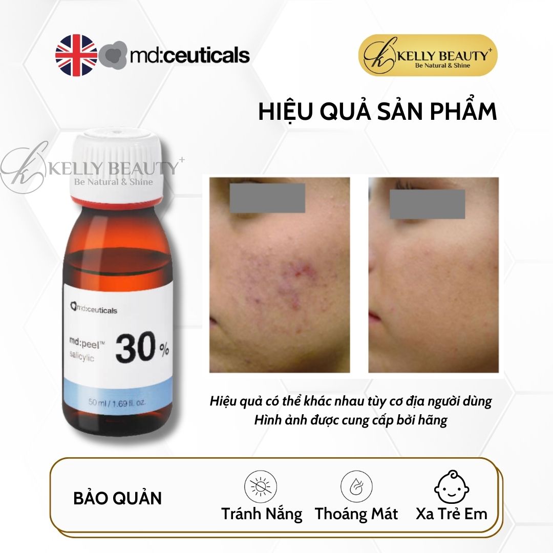 Peel Mụn Sưng Viêm, Mụn Mủ MD:PEEL Salicylic 30% - MD:Ceuticals | Kelly Beauty