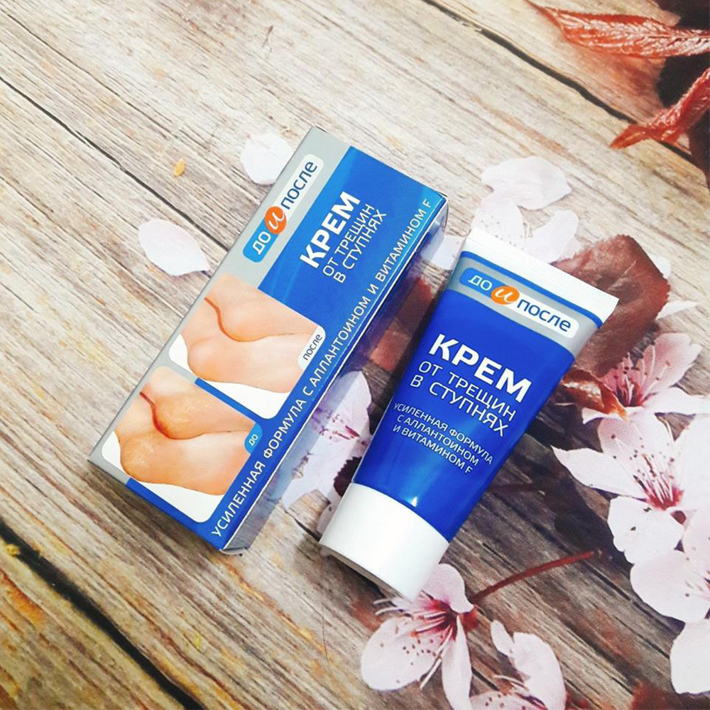 Kem Ngừa Nứt Gót Chân KPEM Dưỡng Ẩm và Làm Mềm 50ml NGA. Tặng Gel Móc Khóa 30ml