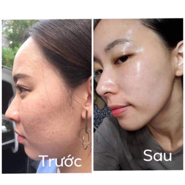Serum Căng Bóng Da Tinh Chất Cá Hồi MULBERRY - 3 Ngày Dưỡng Trắng Mịn Màng, Thu Nhỏ Lỗ Chân Lông - Sản Phẩm Thay Thế Bortox - Tâm Sinh An Cosmetic