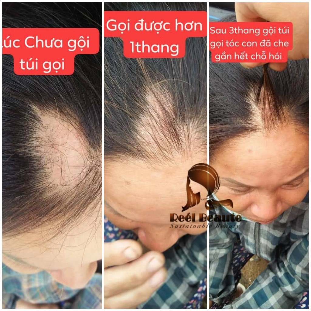 TÚI LỌC GỘI ĐẦU THIÊN NHIÊN REE'L BEAUTE - DÒNG CAO CẤP