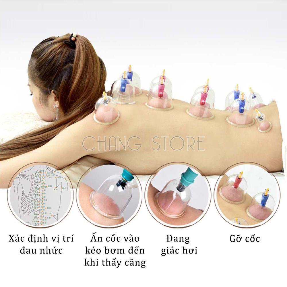 Bộ giác hơi không dùng lửa 12 cốc chất liệu nhựa trong suốt cao cấp, hiệu quả