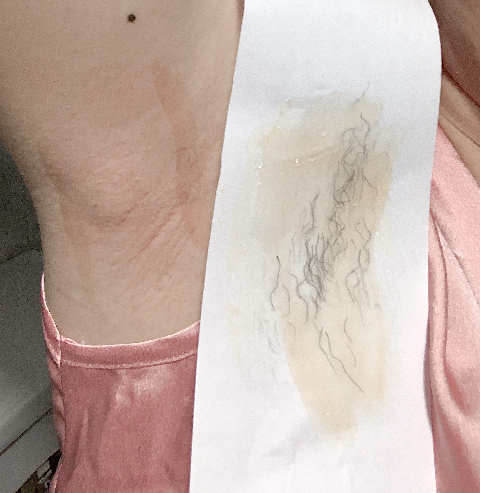 Combo triệt lông Wax + Mỡ Trăn An Lành