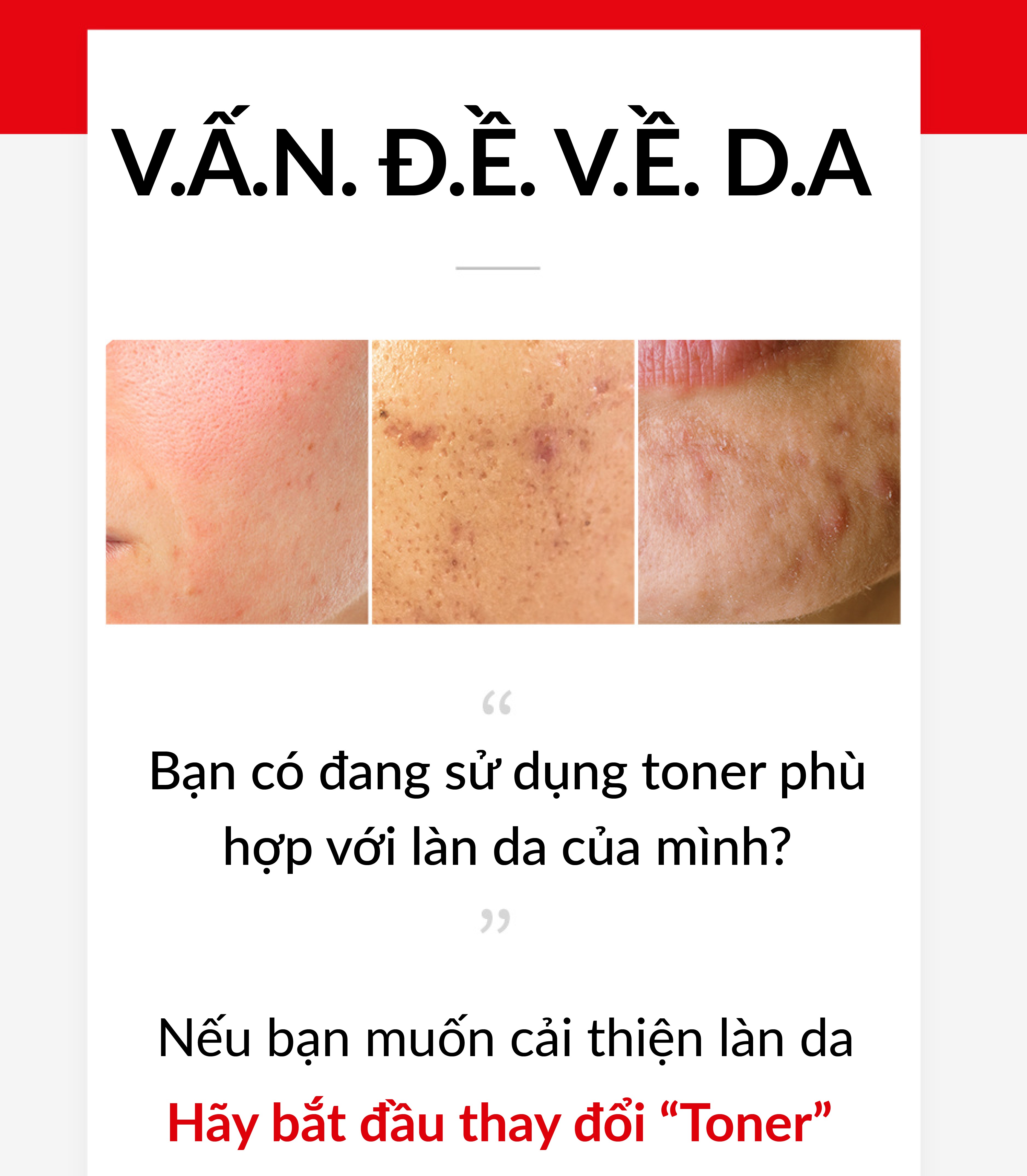 Nước cân bằng làm dịu da mụn AC+ CLEARING TONER