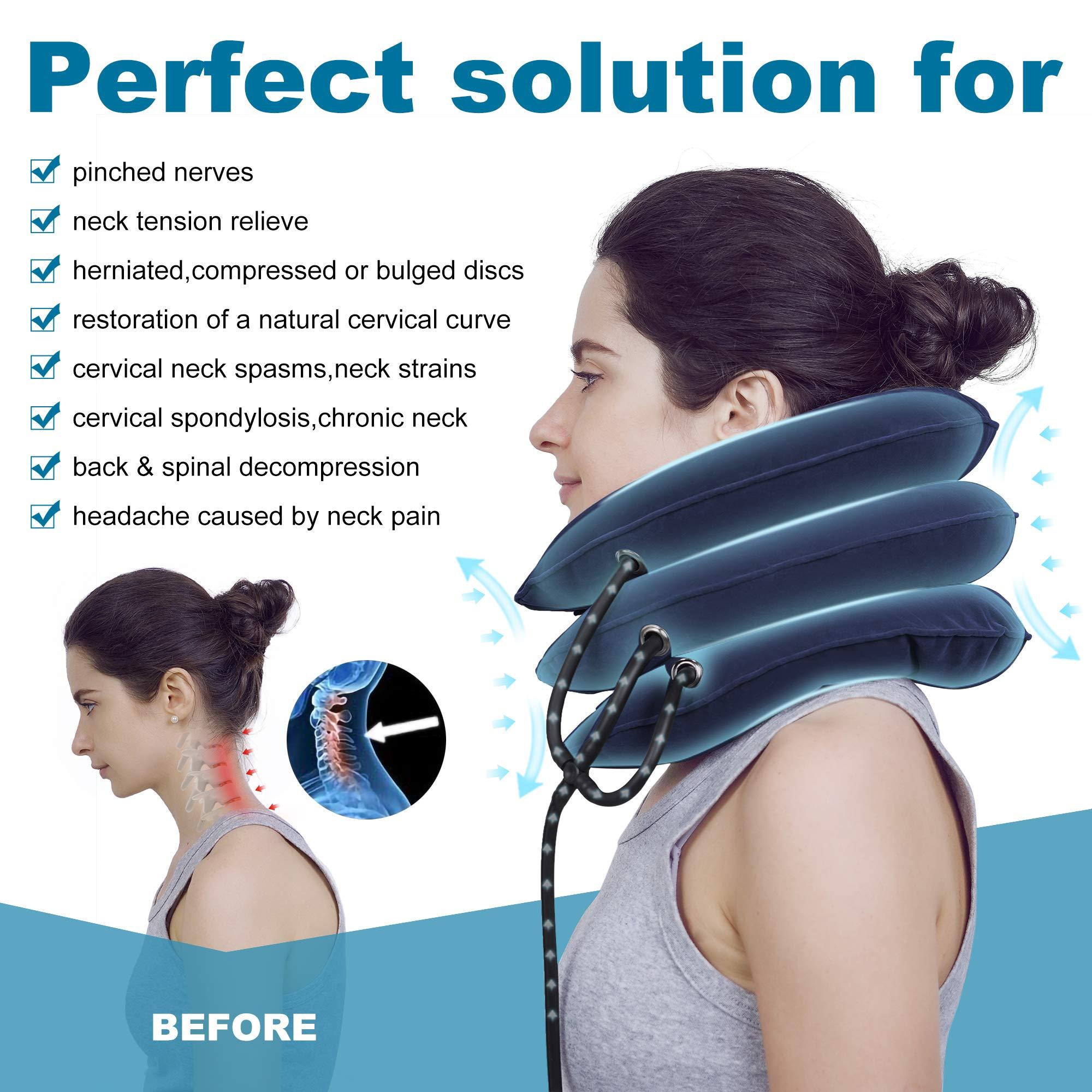 Thiết bị kéo cổ tử cung và Dụng cụ mở rộng cổ bơm hơi có thể điều chỉnh để hỗ trợ cổ, kéo cổ và giảm đau cổ tử cung