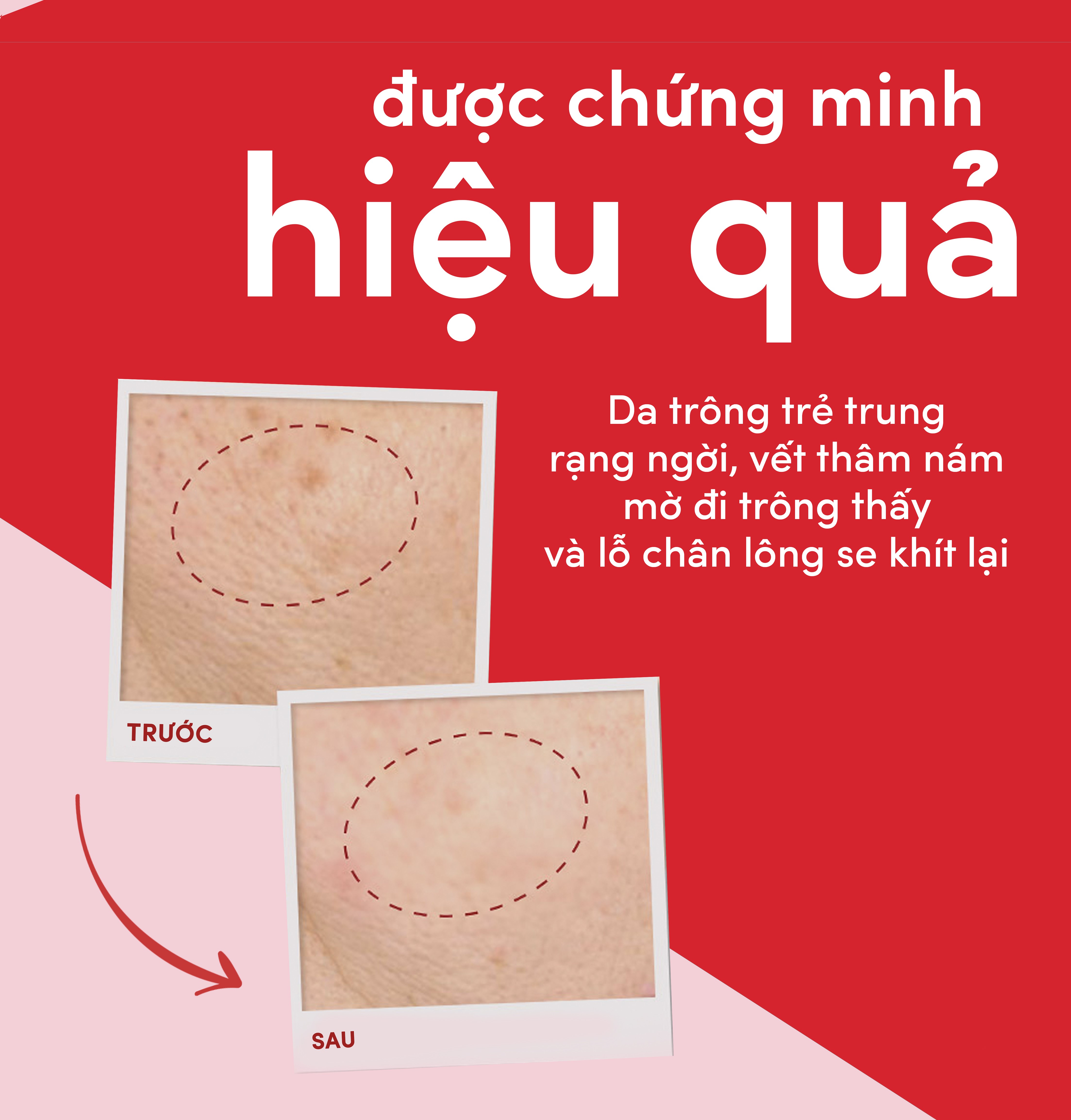 Combo kem dưỡng ẩm ngày, đêm và essence Pond's Age Miracle