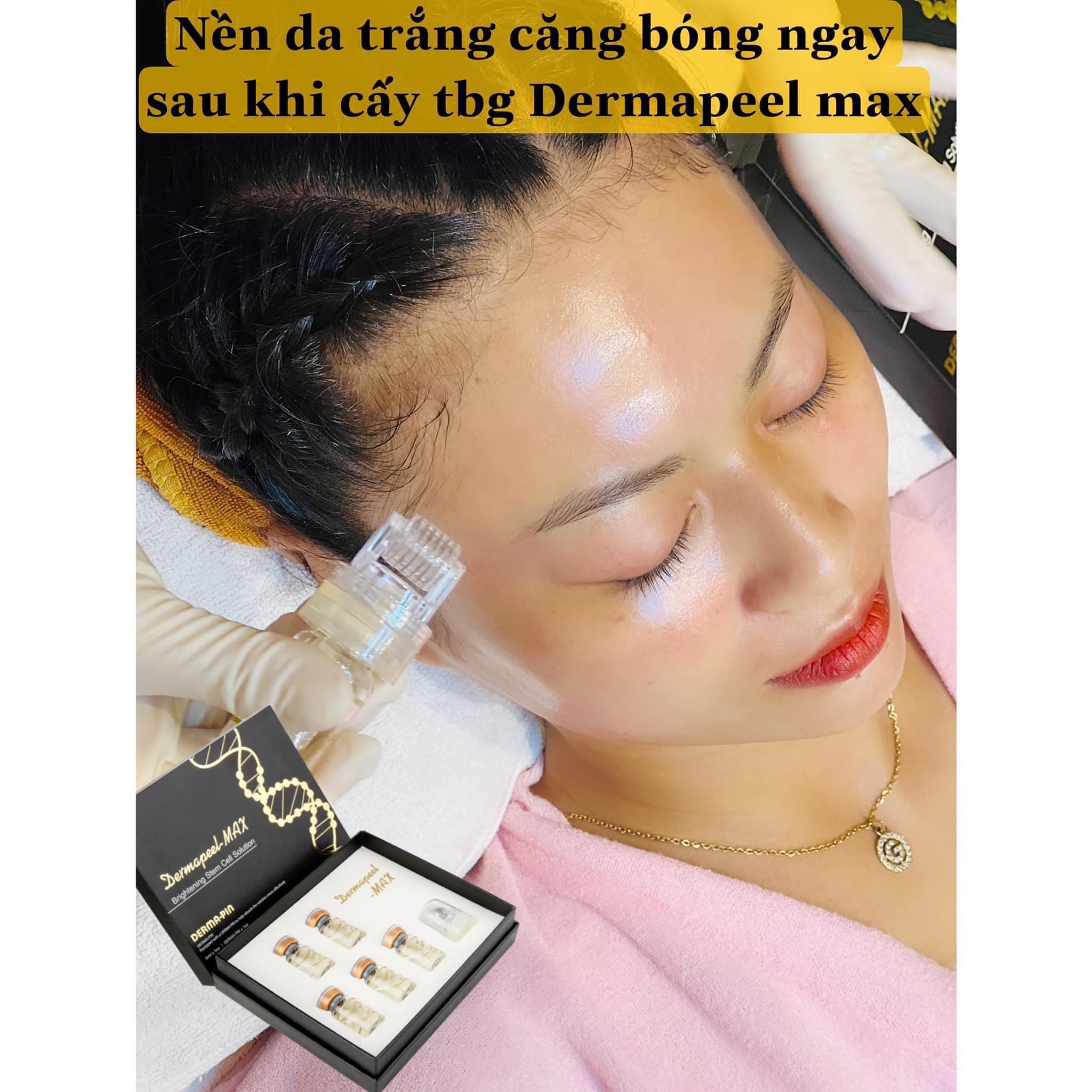 TẾ BÀO GỐC DERMAPEEL MAX GIẢI PHÁP HOÀN HẢO CHO LÀN DA,CHỐNG LÃO HOÁ DA