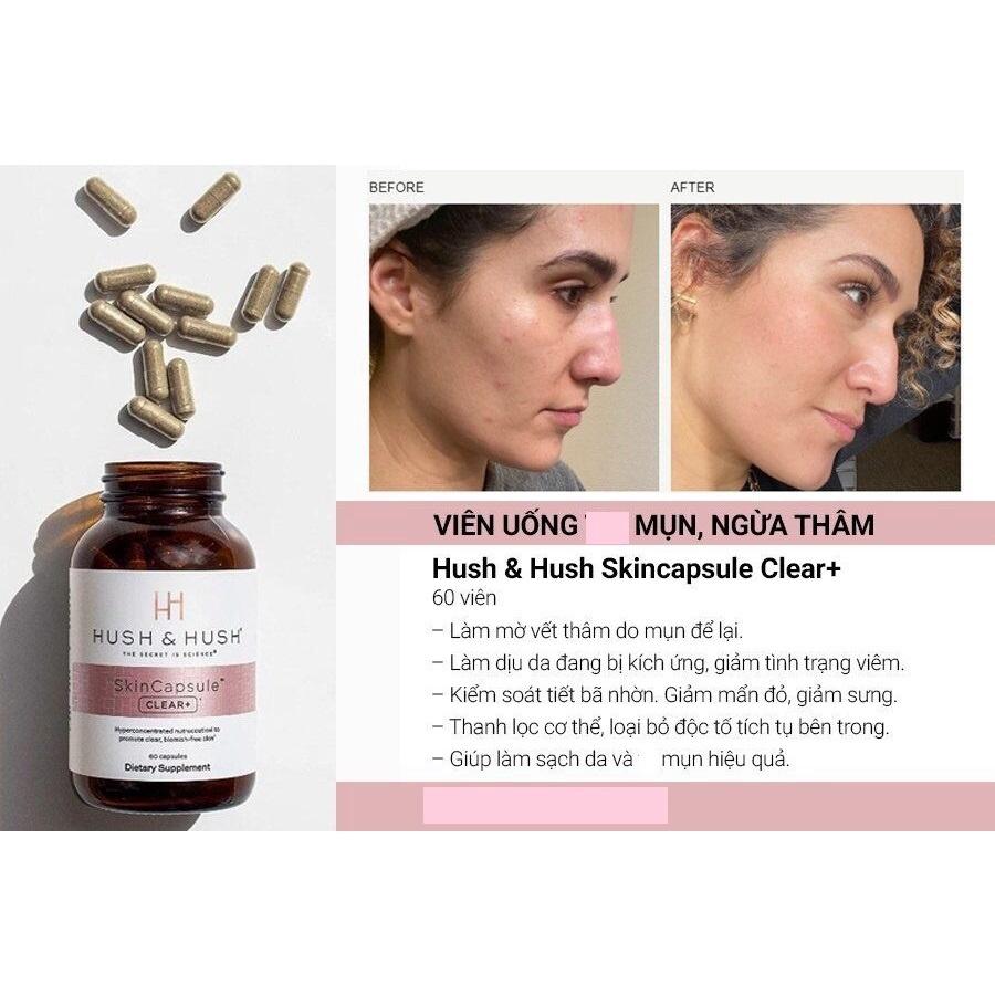 HÀNG NHẬP KHẨU - Viên Uống Ngăn Ngừa Giảm Mụn Image Skincare Hush & Hush SkinCapsule Clear+ Hộp 60 Viên
