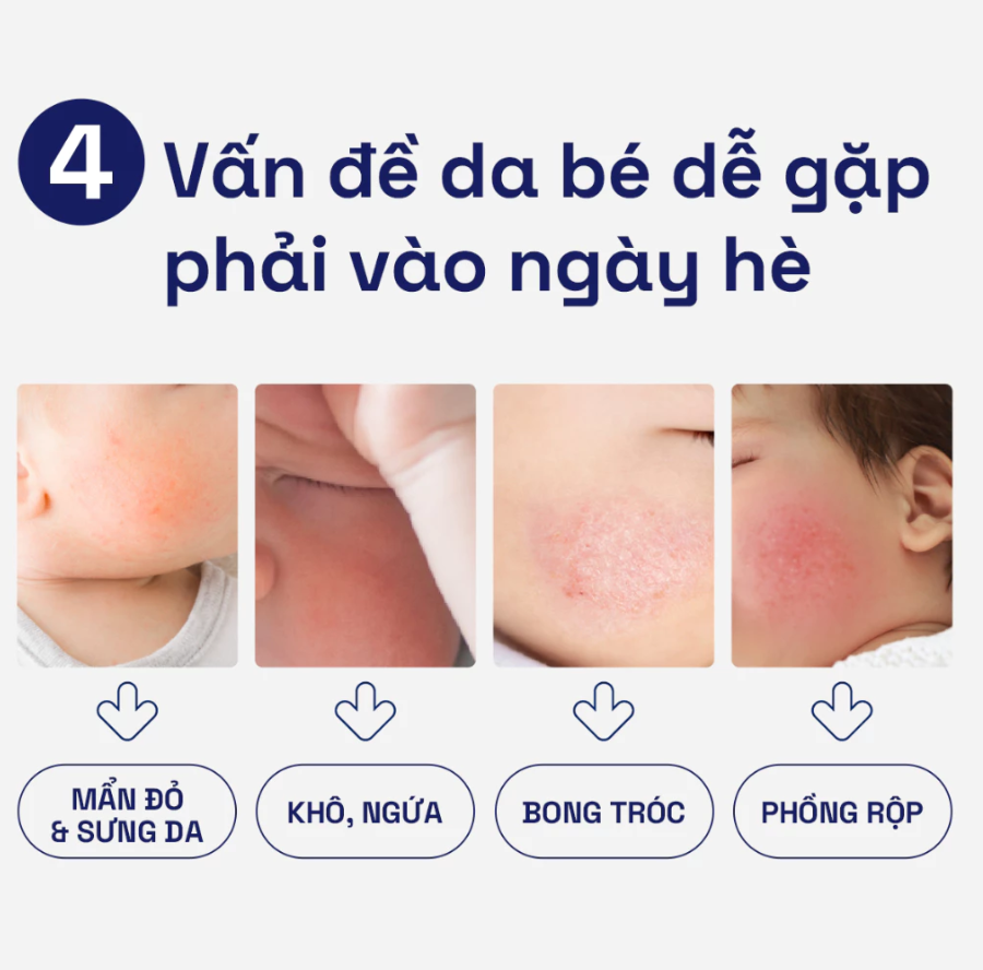 Kem Dưỡng Ẩm Làm Dịu Cho Bé Cetaphil Baby 566G