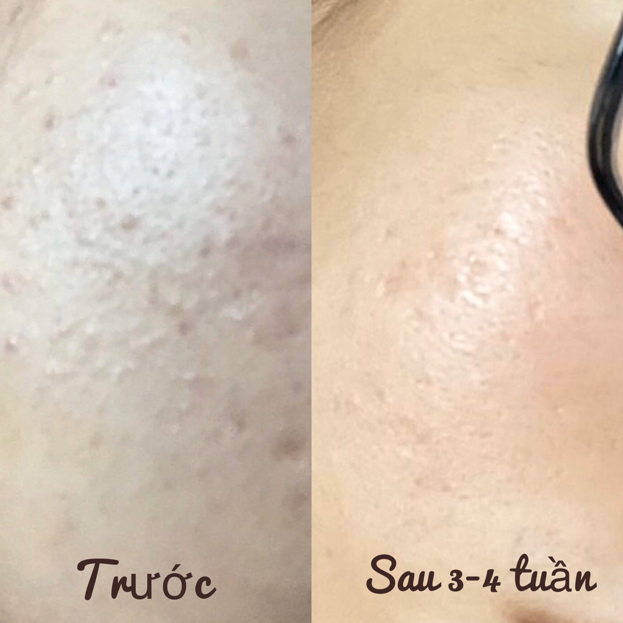 Bộ Sản Phẩm Sạch Sâu Trắng Sáng Căng Bóng Toàn Diện gồm Tinh chất AHA 10ml và Tinh chất B3 10% 10ml Zakka Naturals